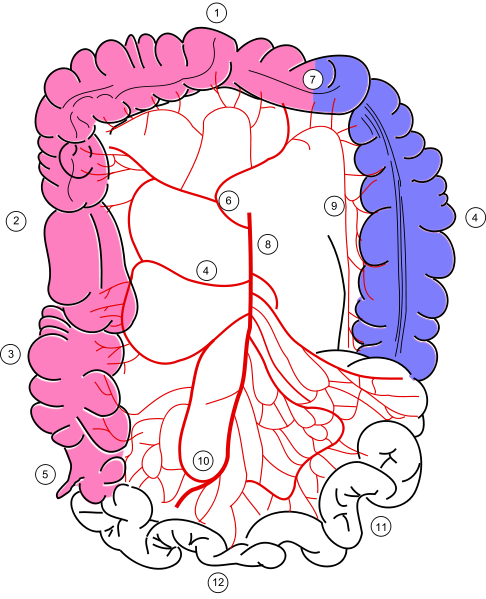 Mesenteric Ischemia - Dr Vineeth's Vascular Clinic - Best Vascular Care